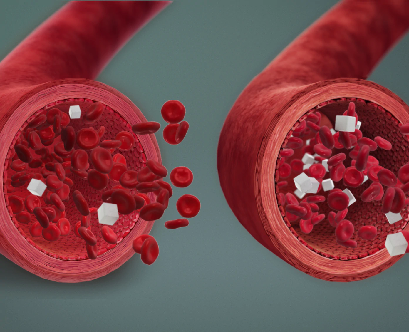 Blood sugar in vessels