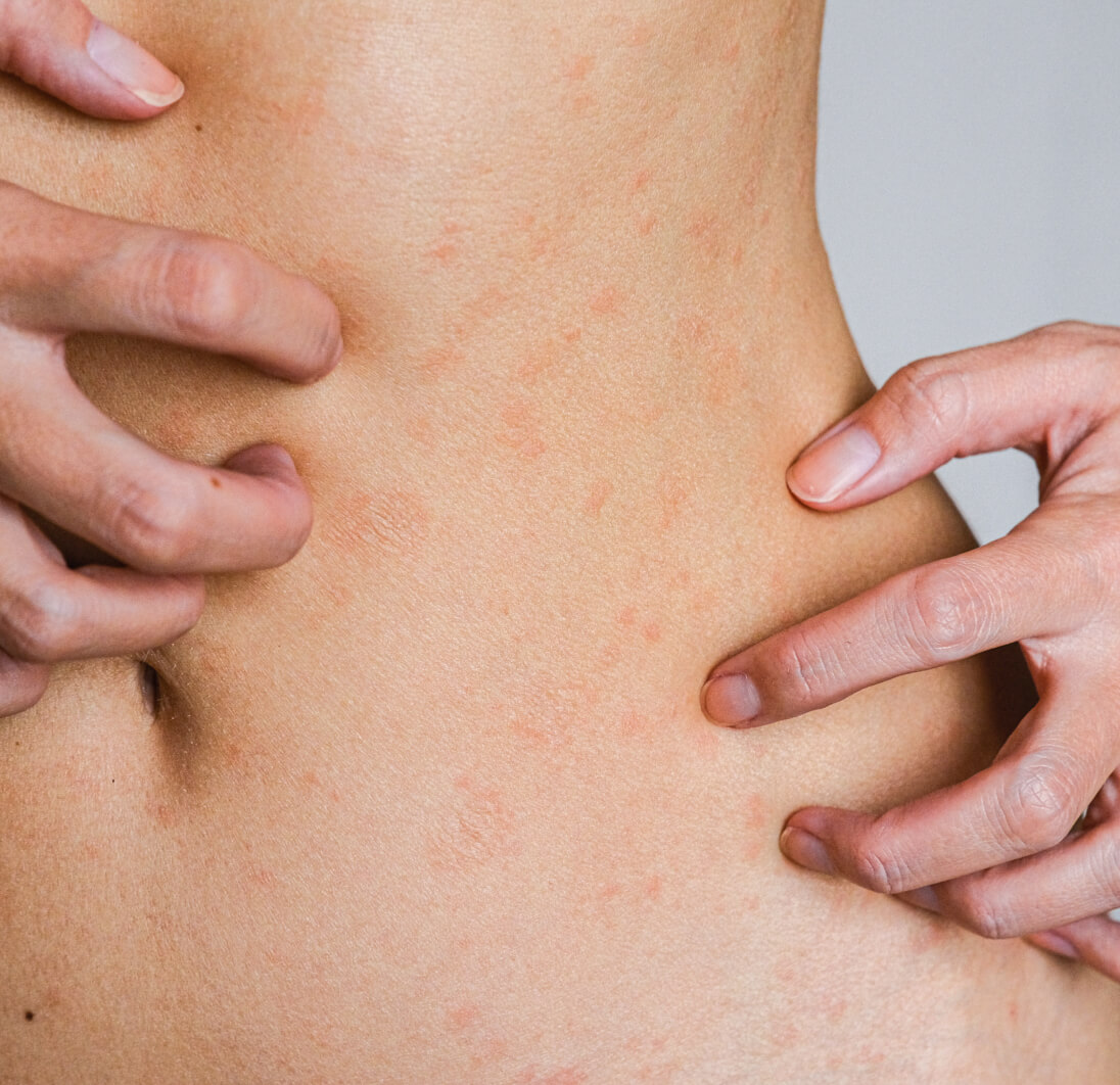 Skin problems