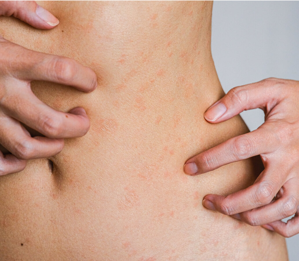 Skin problems