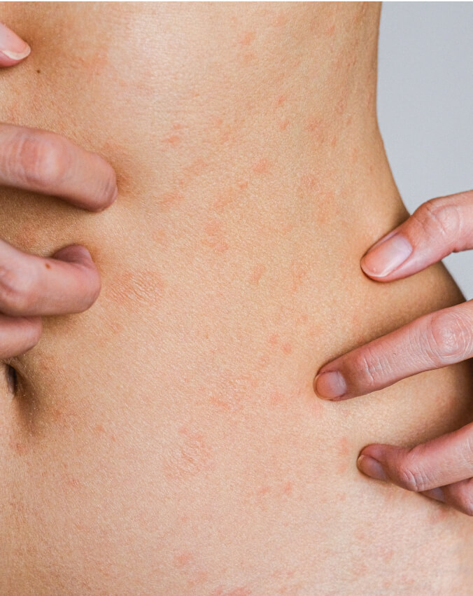 Skin problems