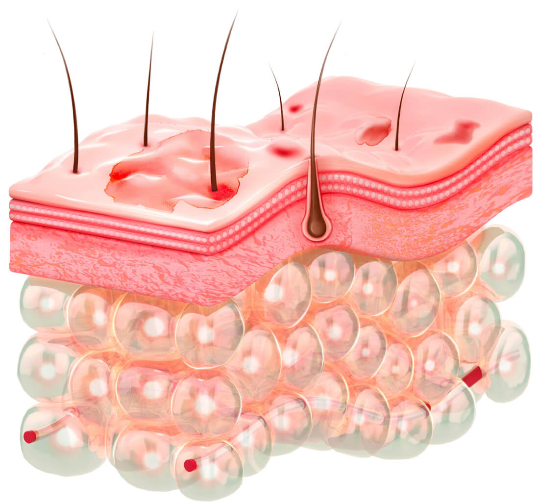 Skin epidermis