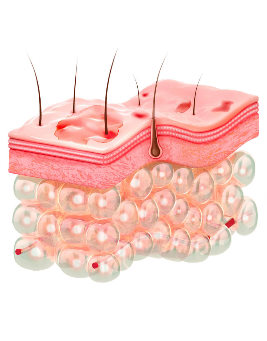 Skin epidermis