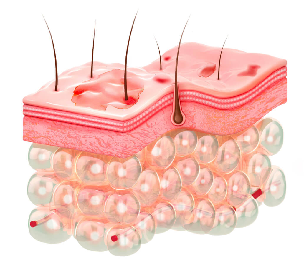 Skin epidermis