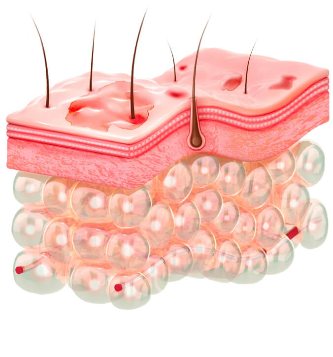 Skin epidermis